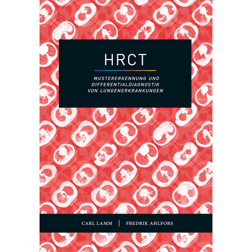 Carl Lamm HRCT : mustererkennung und Differentialdiagnostik von Lungenerkrankungen (bok, danskt band, ger)