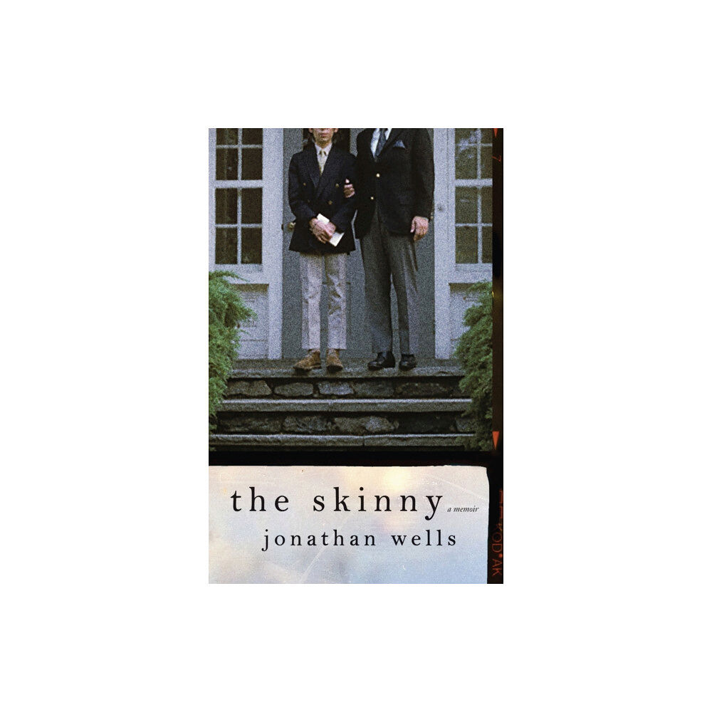 ZE Books The Skinny (inbunden, eng)