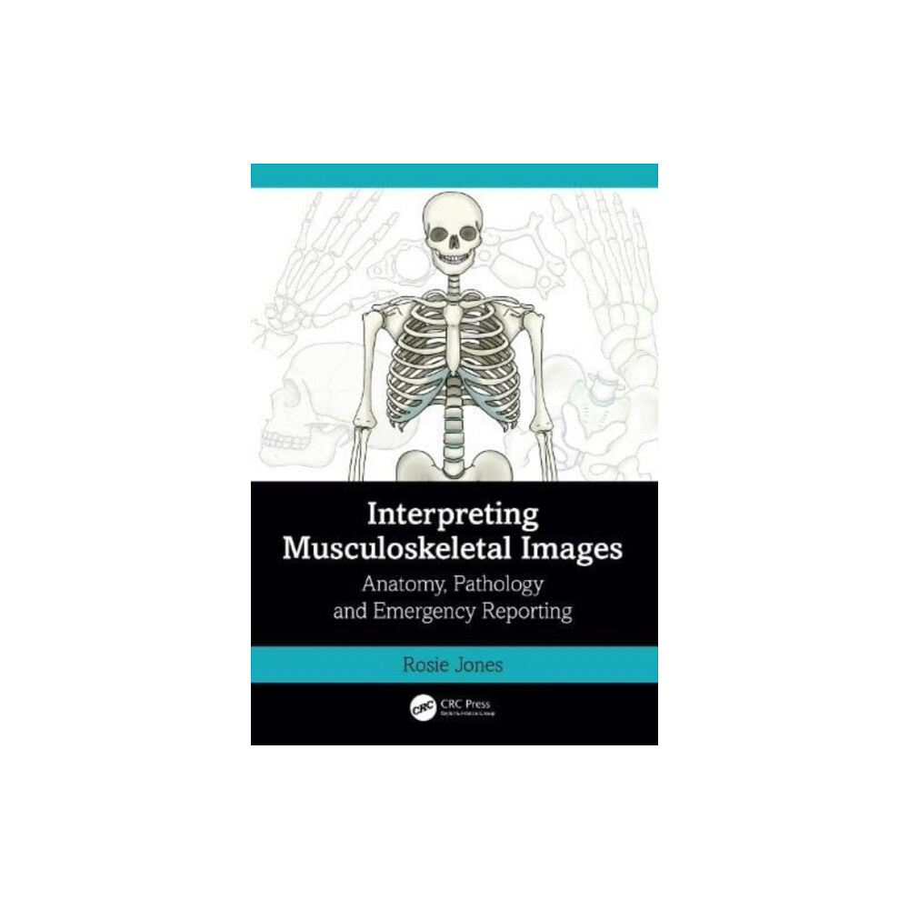Taylor & francis ltd Interpreting Musculoskeletal Images (häftad, eng)