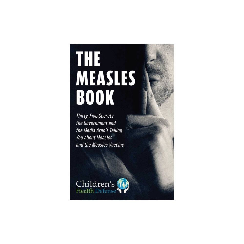 Skyhorse Measles Book (inbunden, eng)