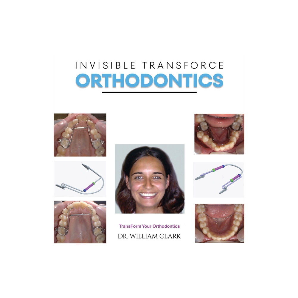 Austin Macauley Publishers Invisible TransForce Orthodontics (inbunden, eng)