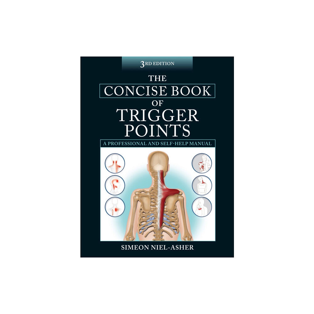 Lotus Publishing Limited The Concise Book of Trigger Points (häftad, eng)