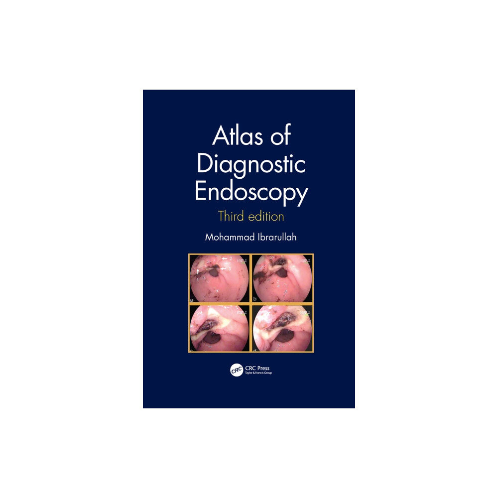 Taylor & francis ltd Atlas of Diagnostic Endoscopy, 3E (häftad, eng)