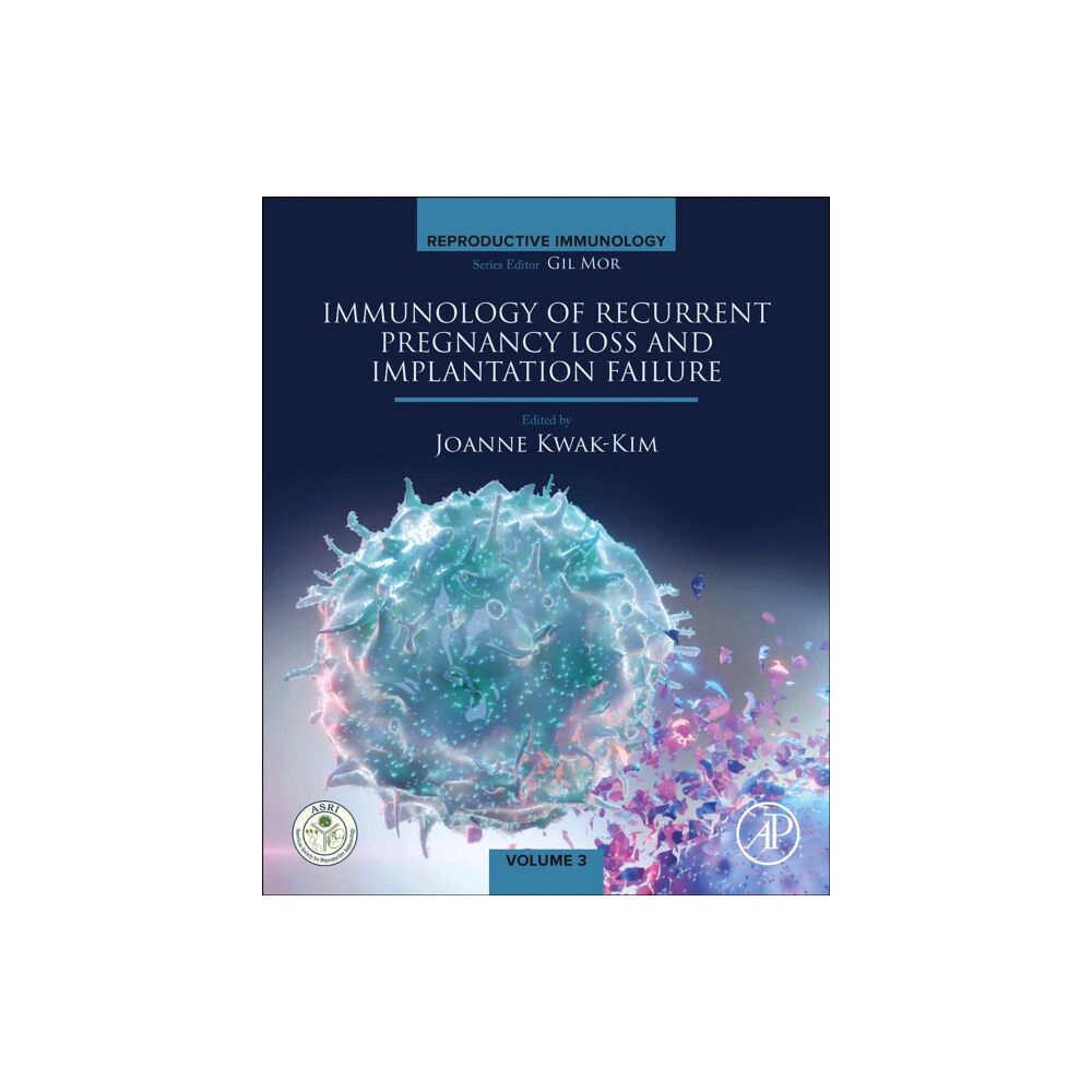 Elsevier Science & Technology Immunology of Recurrent Pregnancy Loss and Implantation Failure (häftad, eng)