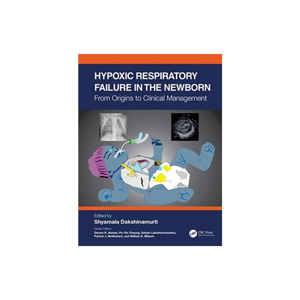 Taylor & francis ltd Hypoxic Respiratory Failure in the Newborn (häftad, eng)