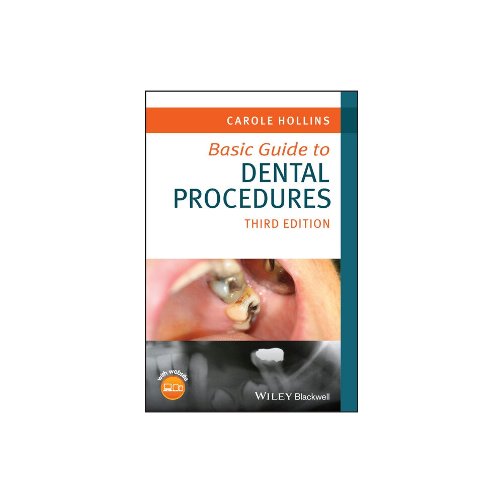 John Wiley & Sons Inc Basic Guide to Dental Procedures (häftad, eng)