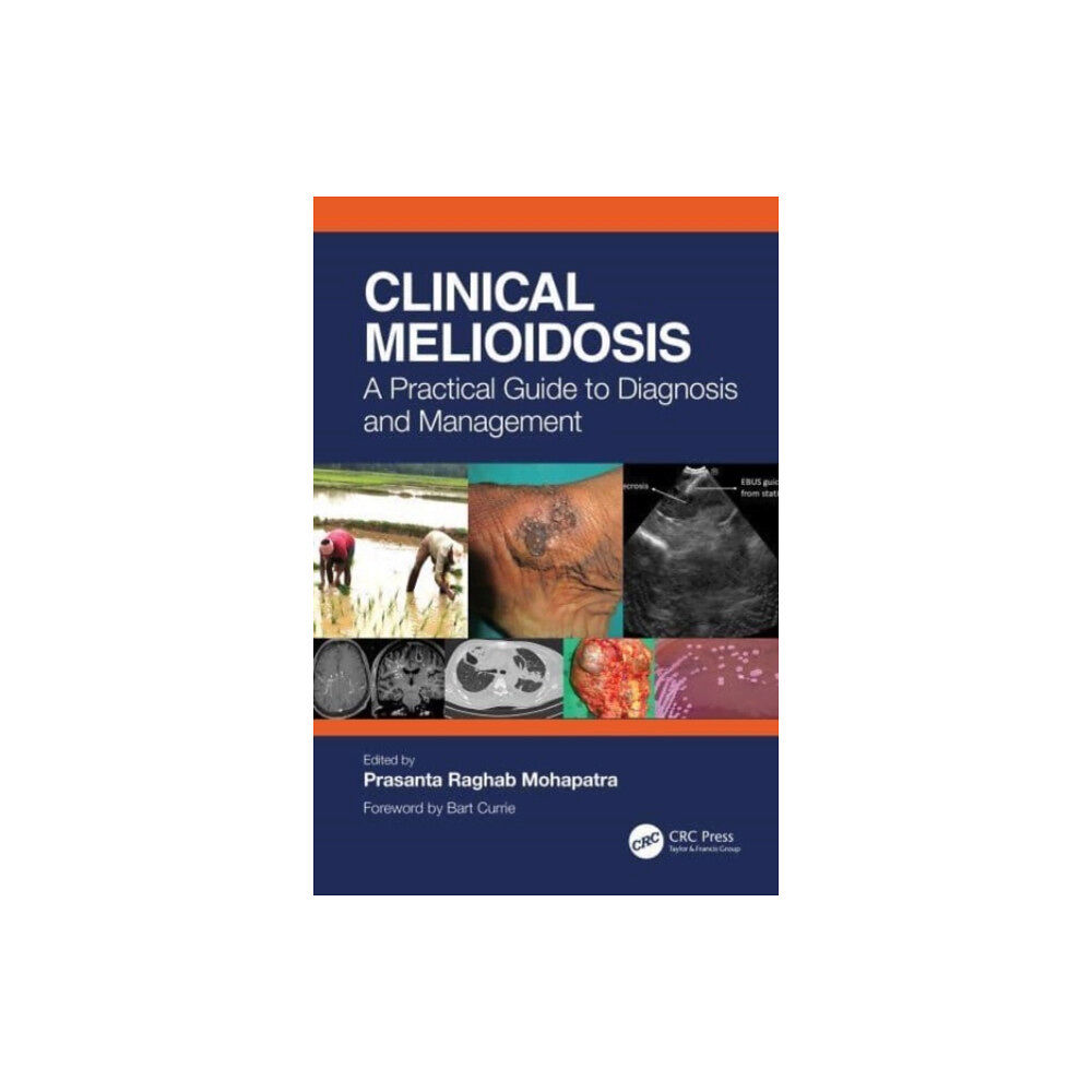 Taylor & francis ltd Clinical Melioidosis (häftad, eng)