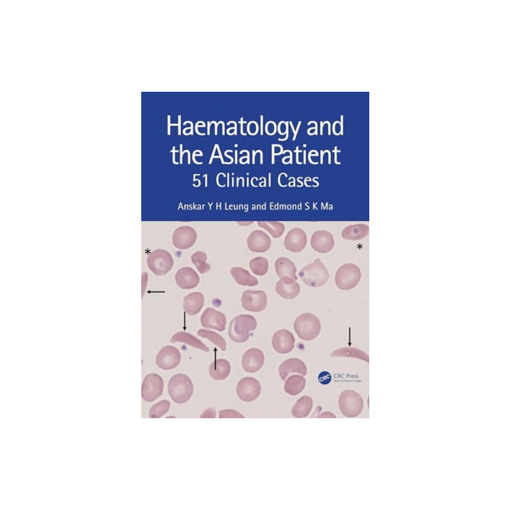 Taylor & francis ltd Haematology and the Asian Patient (häftad, eng)