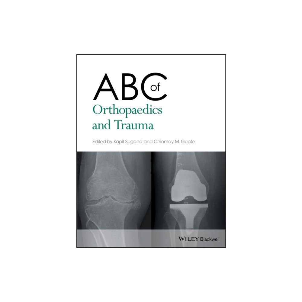 John Wiley And Sons Ltd ABC of Orthopaedics and Trauma (häftad, eng)