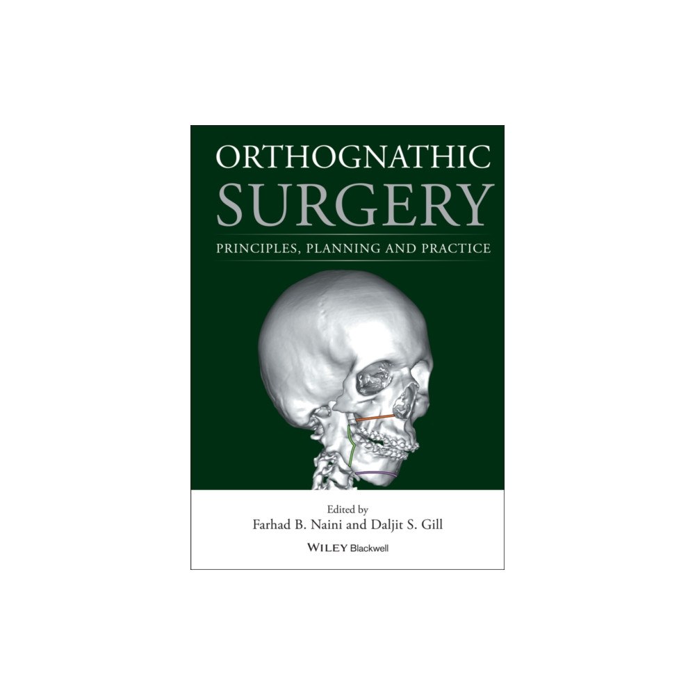 John Wiley And Sons Ltd Orthognathic Surgery (inbunden, eng)