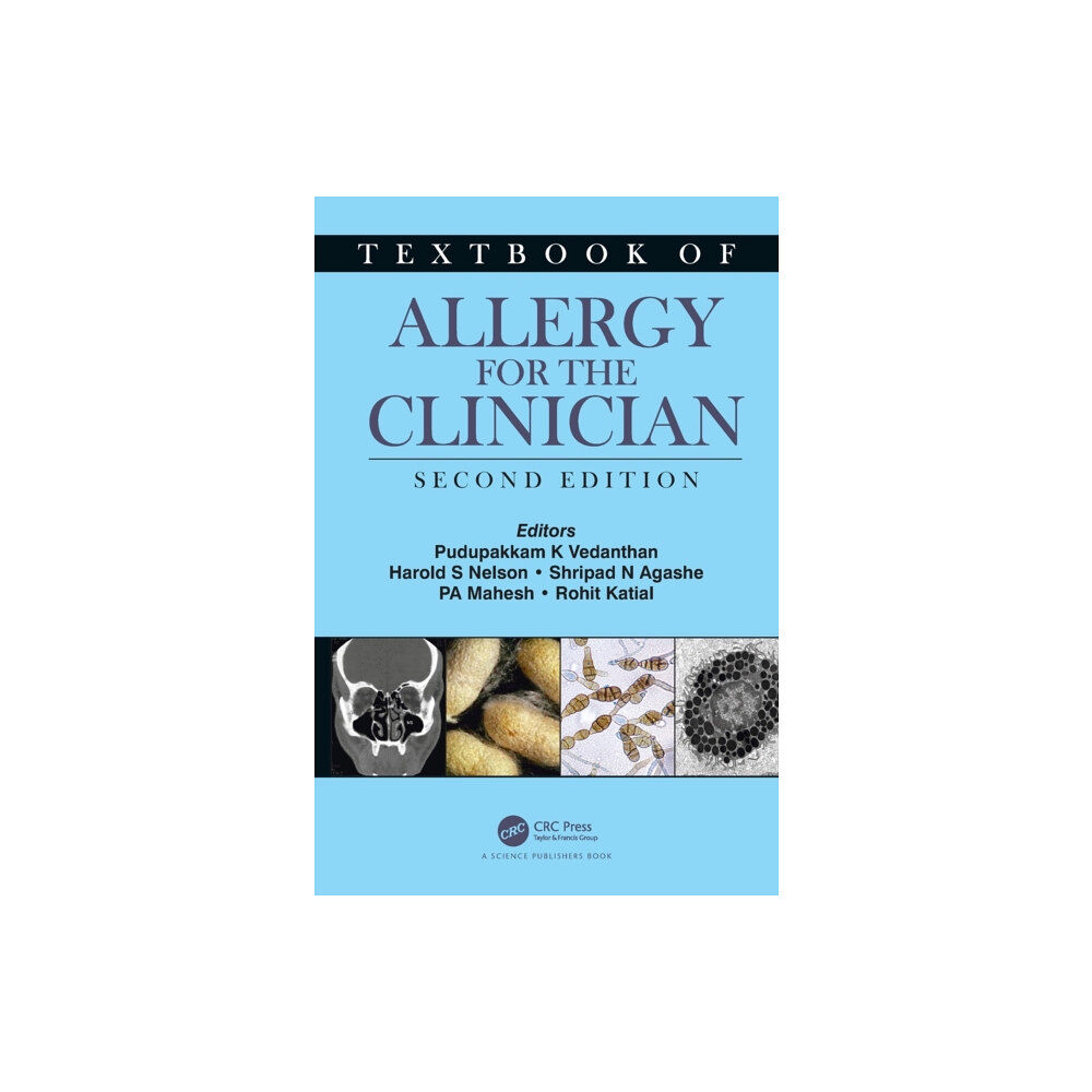 Taylor & francis ltd Textbook of Allergy for the Clinician (inbunden, eng)