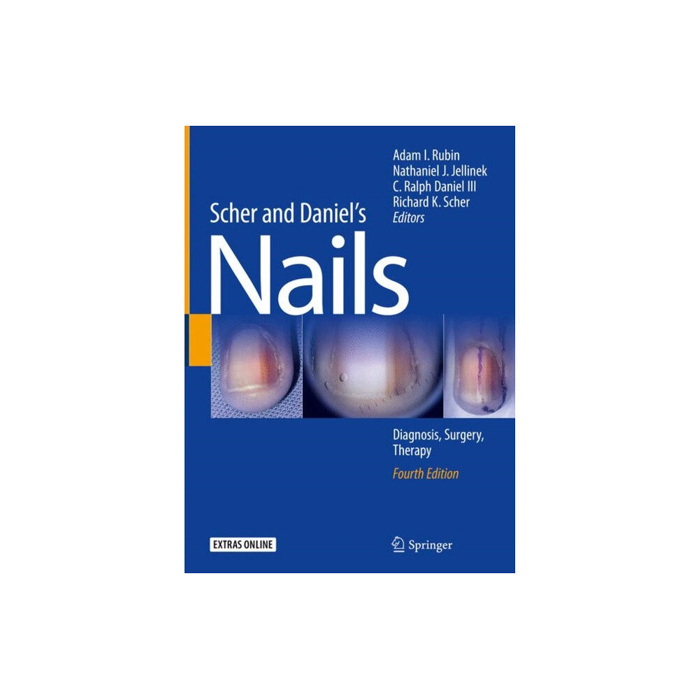 Springer International Publishing AG Scher and Daniel's Nails (inbunden, eng)