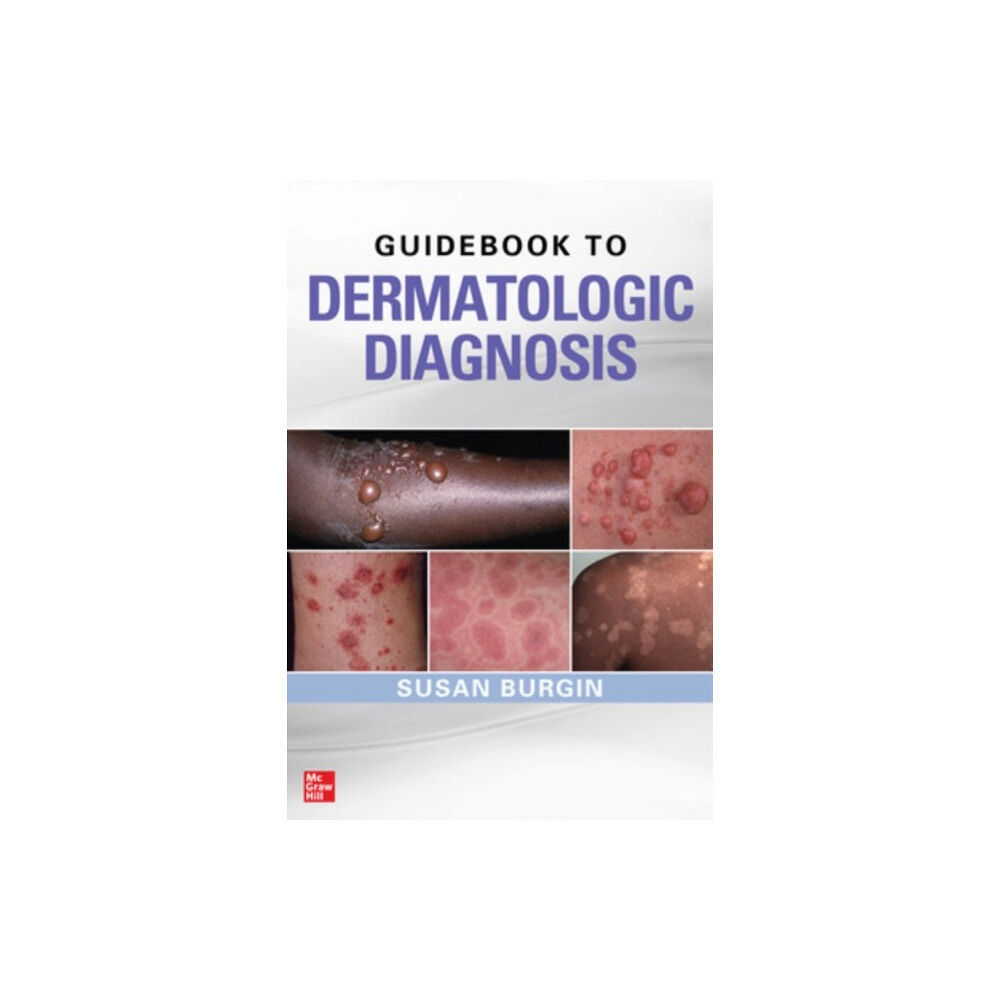 McGraw-Hill Education - Europe Guidebook to Dermatologic Diagnosis (häftad, eng)