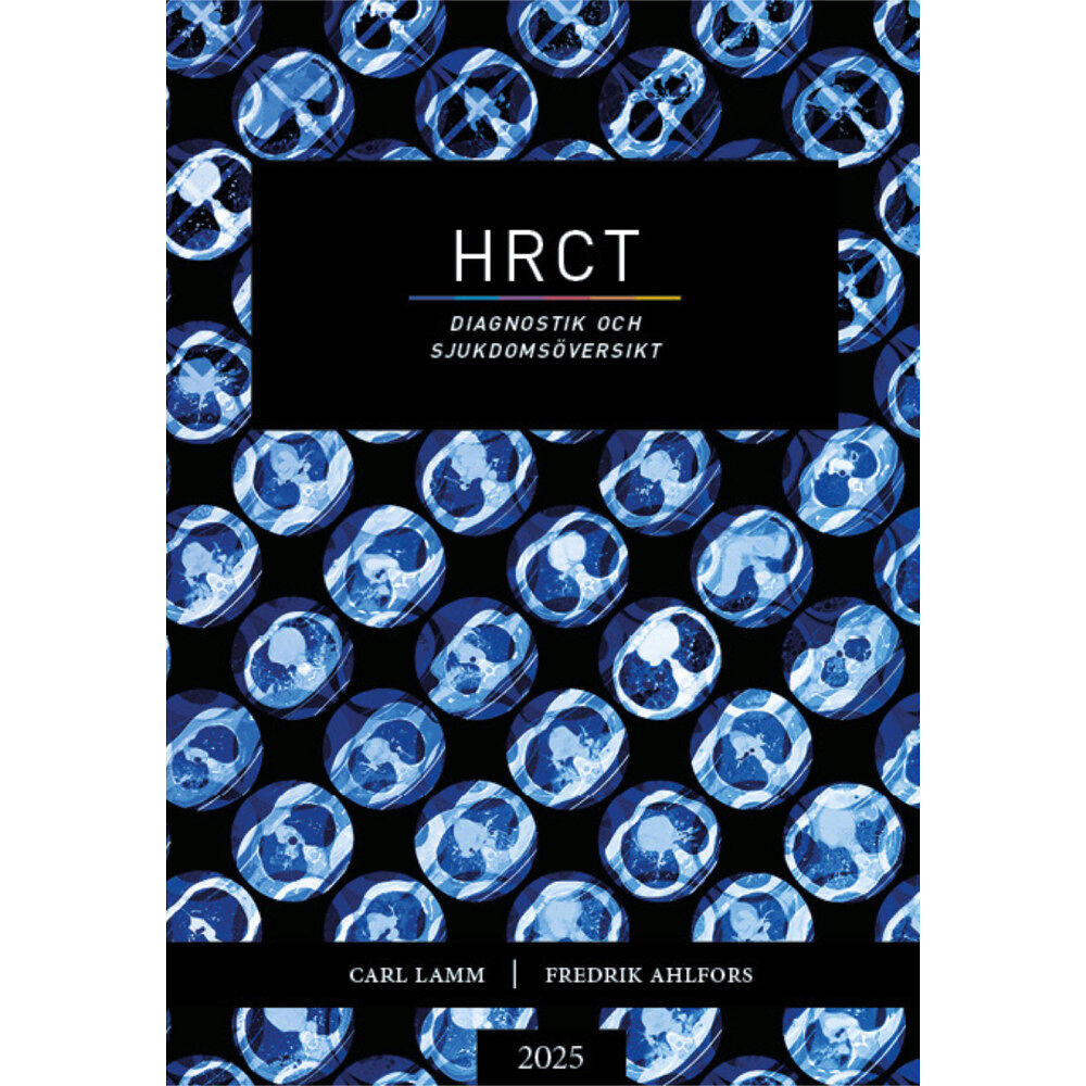 Carl Lamm HRCT : diagnostik och sjukdomsöversikt (bok, danskt band)