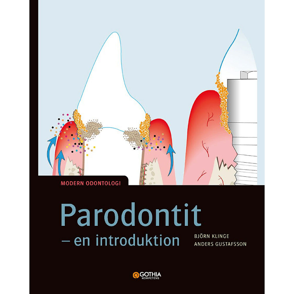 Anders Gustafsson Parodontit : en introduktion (häftad)