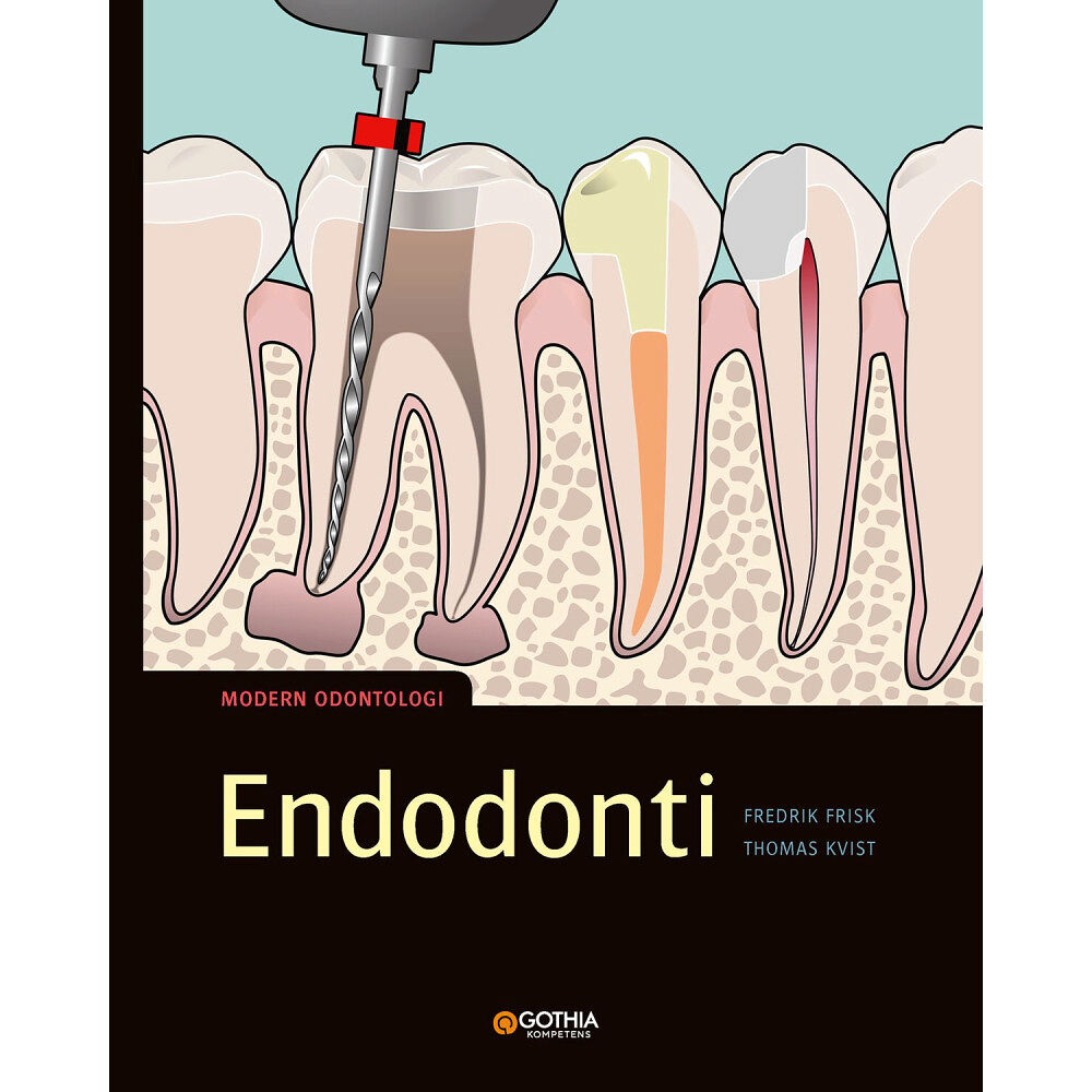 Fredrik Frisk Endodonti (häftad)