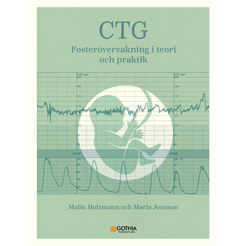 Malin Holzmann CTG : fosterövervakning i teori och praktik (häftad)