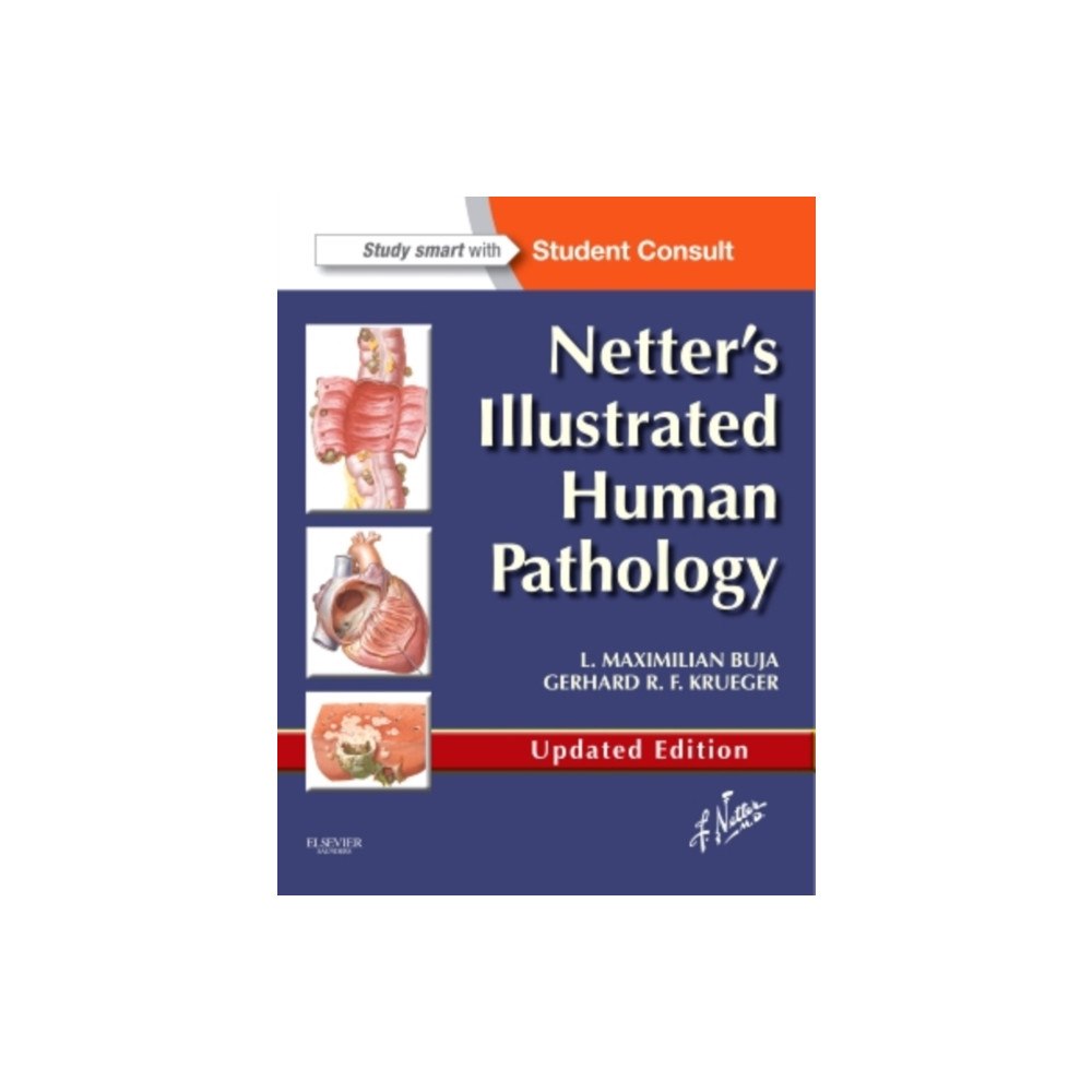 Elsevier - Health Sciences Division Netter's Illustrated Human Pathology Updated Edition (häftad, eng)