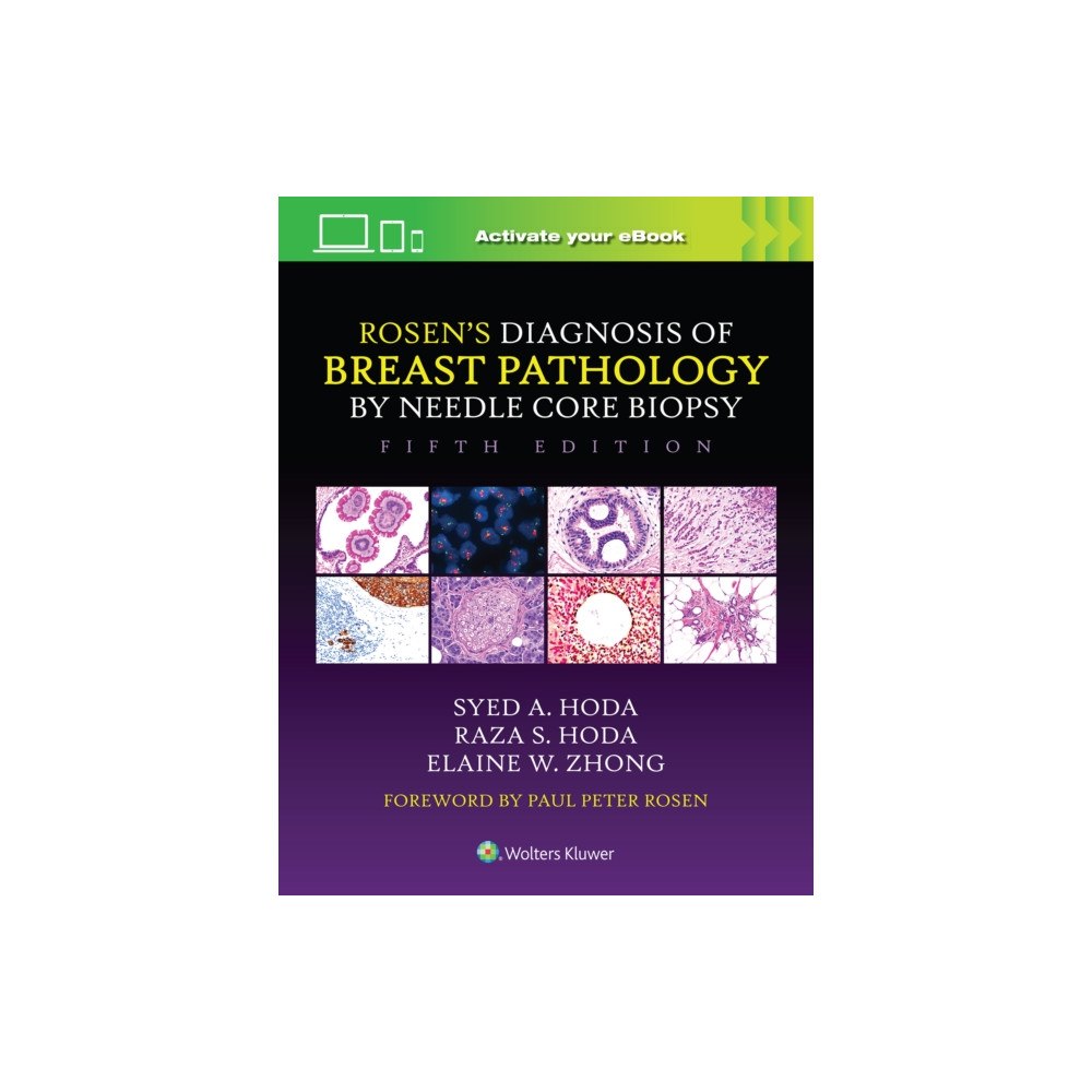 Wolters Kluwer Health Rosen's Diagnosis of Breast Pathology by Needle Core Biopsy (inbunden, eng)