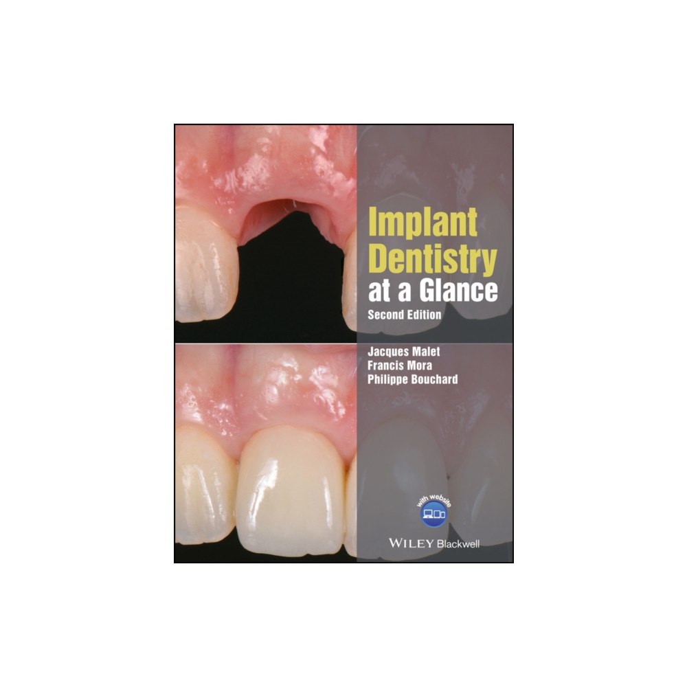 John Wiley And Sons Ltd Implant Dentistry at a Glance (häftad, eng)