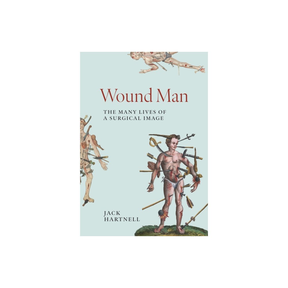 Princeton University Press Wound Man (inbunden, eng)