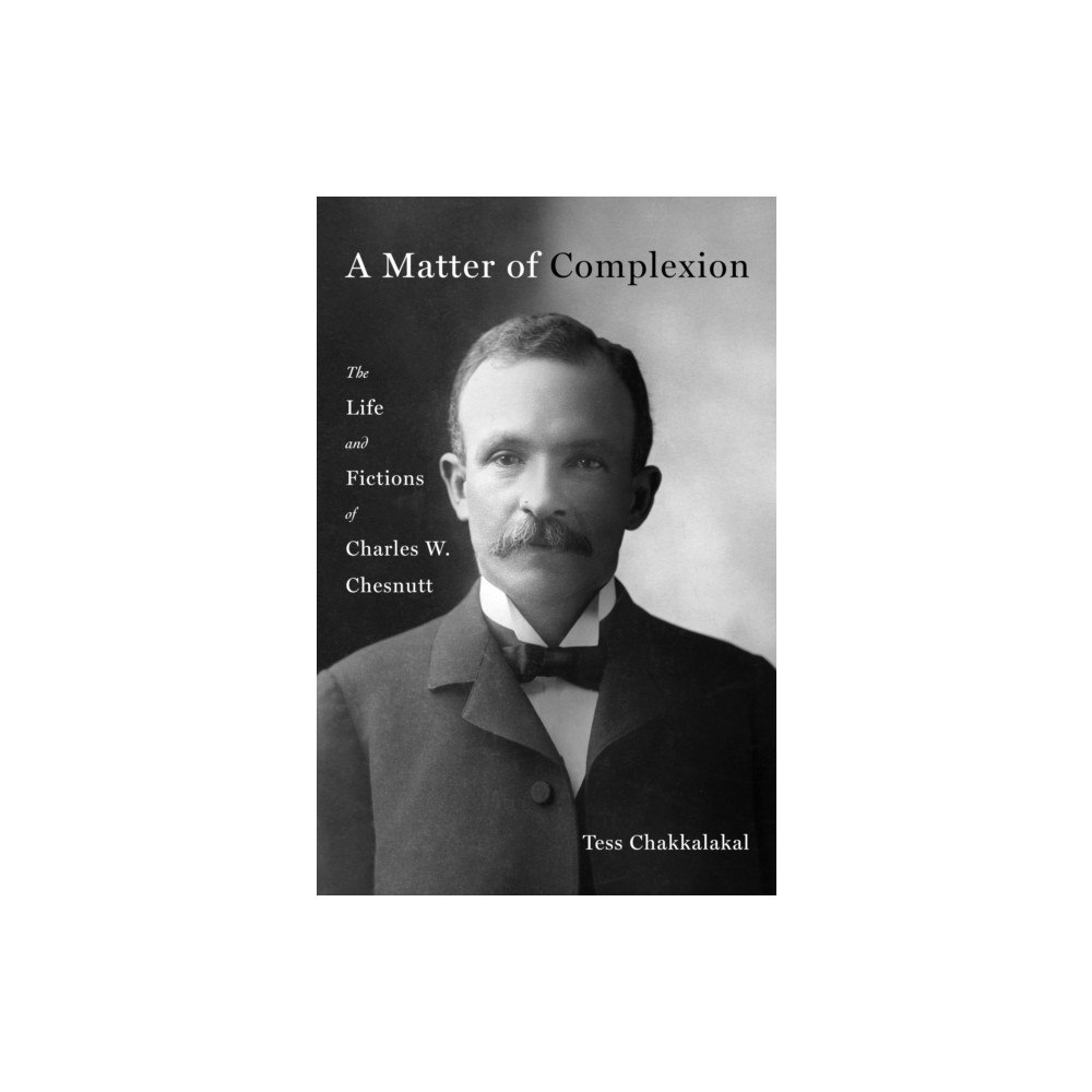 St Martin's Press A Matter of Complexion (inbunden, eng)