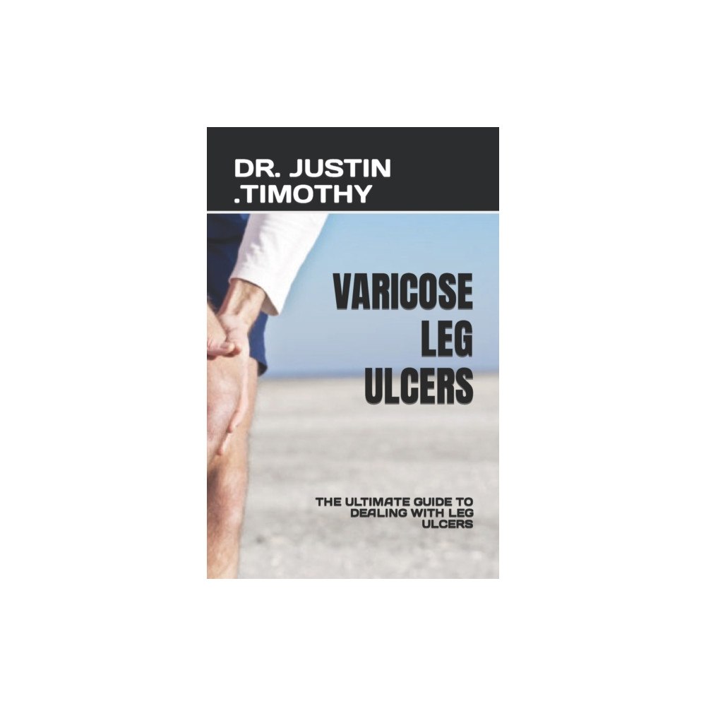 Independently Published Varicose Leg Ulcers (häftad, eng)