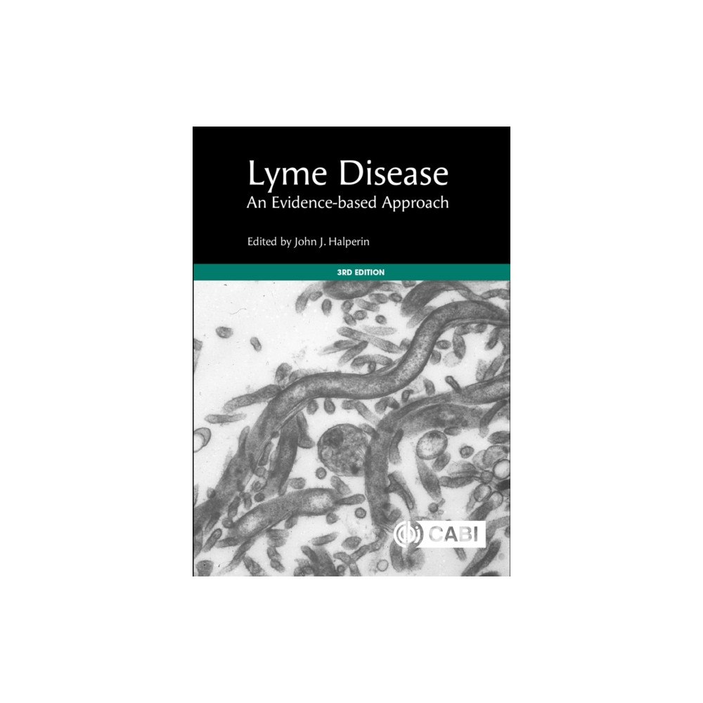 CABI Publishing Lyme Disease (inbunden, eng)