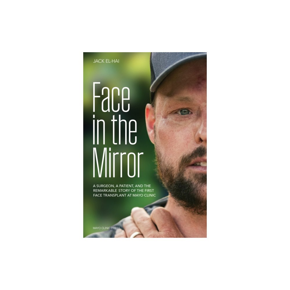 Taylor & francis ltd Face Transplant (inbunden, eng)