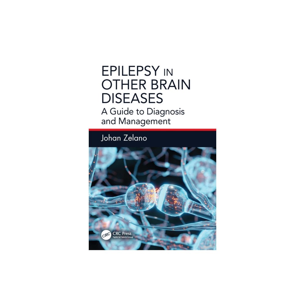 Taylor & francis ltd Epilepsy in Other Brain Diseases (häftad, eng)