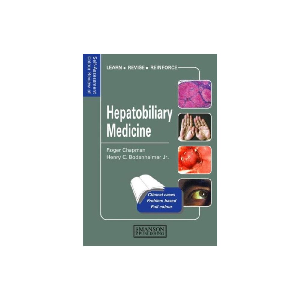 Manson Publishing Ltd Hepatobiliary Medicine (häftad, eng)