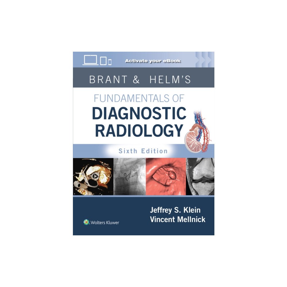 Wolters Kluwer Health Brant & Helms' Fundamentals of Diagnostic Radiology: Print + eBook with Multimedia (inbunden, eng)