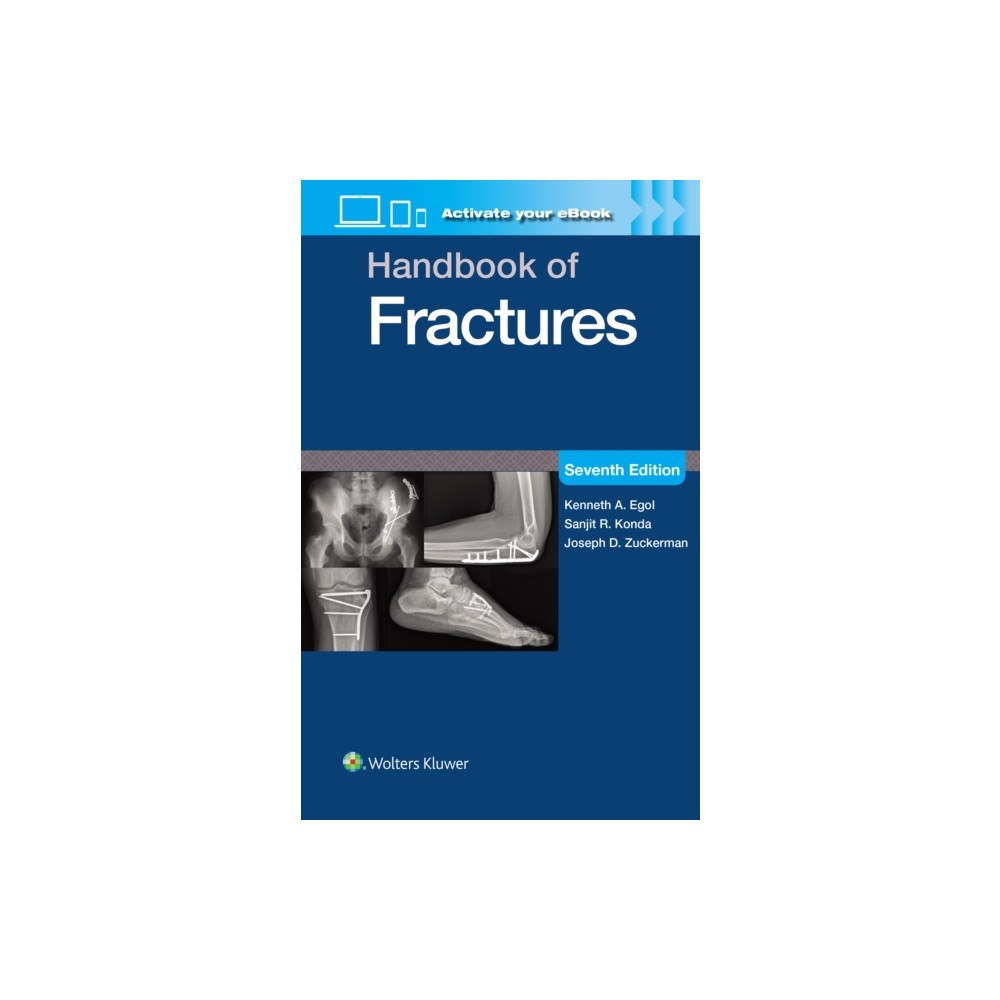 Wolters Kluwer Health Handbook of Fractures: Print + eBook with Multimedia (häftad, eng)