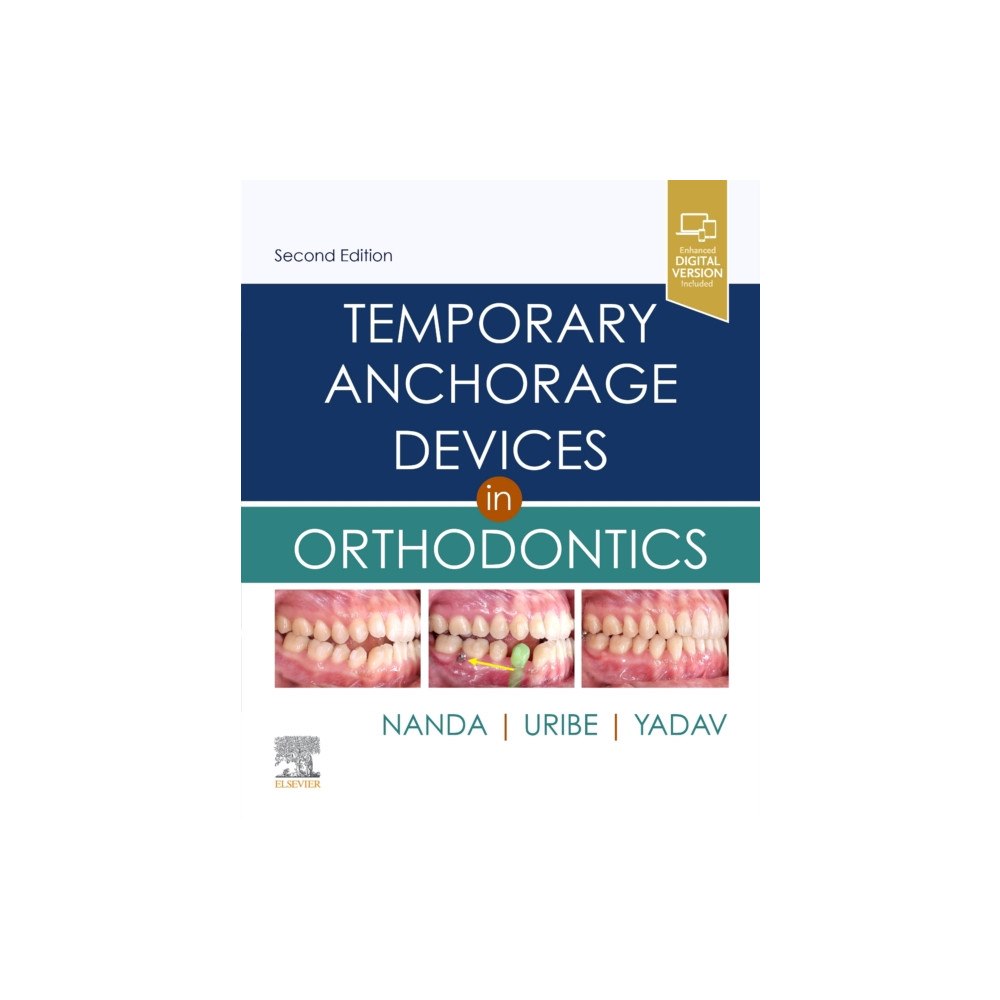 Elsevier - Health Sciences Division Temporary Anchorage Devices in Orthodontics (inbunden, eng)