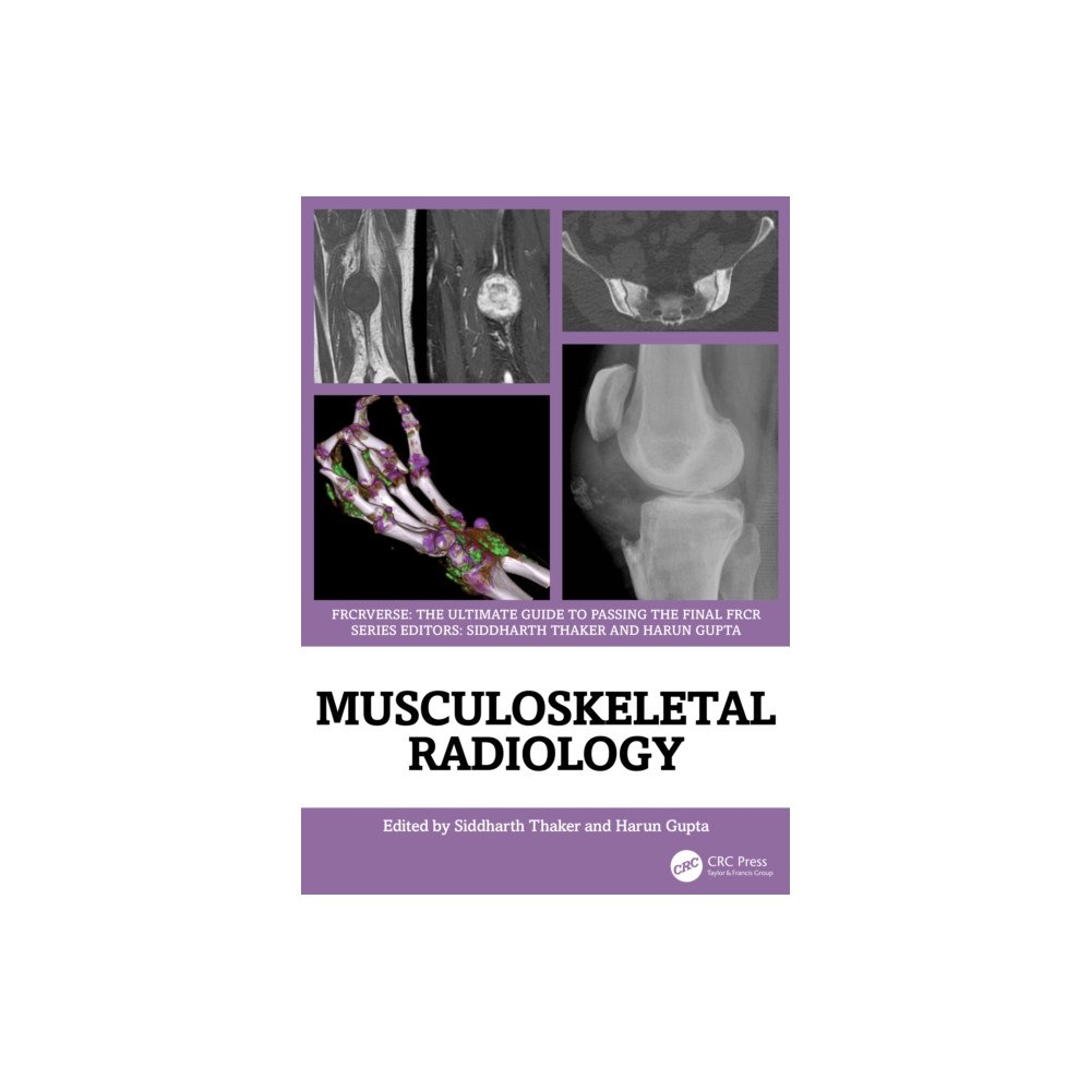 Taylor & francis ltd Musculoskeletal Radiology (häftad, eng)