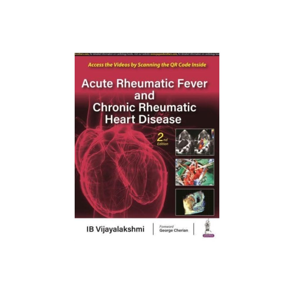 Jaypee Brothers Medical Publishers Acute Rheumatic Fever and Chronic Rheumatic Heart Disease (inbunden, eng)