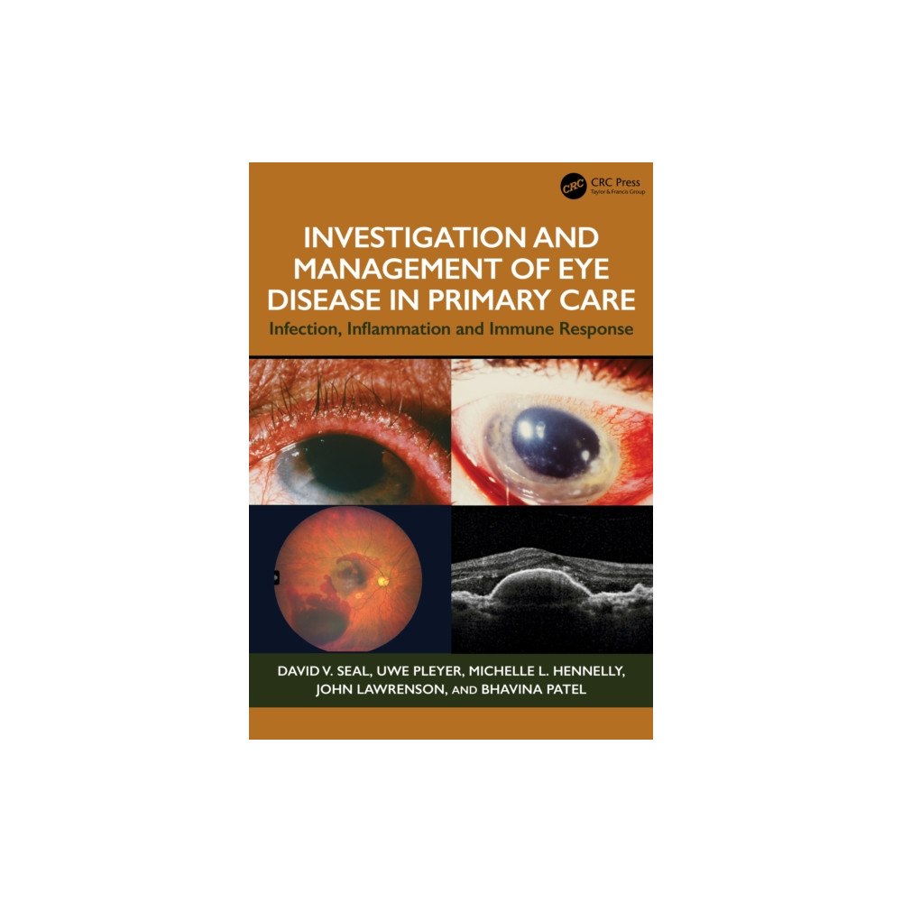 Taylor & francis ltd Investigation & Management of Eye Disease in Primary Care (häftad, eng)