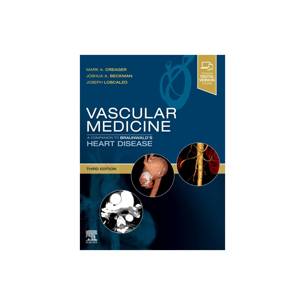 Elsevier - Health Sciences Division Vascular Medicine: A Companion to Braunwald's Heart Disease (inbunden, eng)