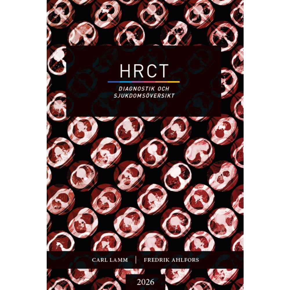 Carl Lamm HRCT : diagnostik och sjukdomsöversikt (bok, danskt band)