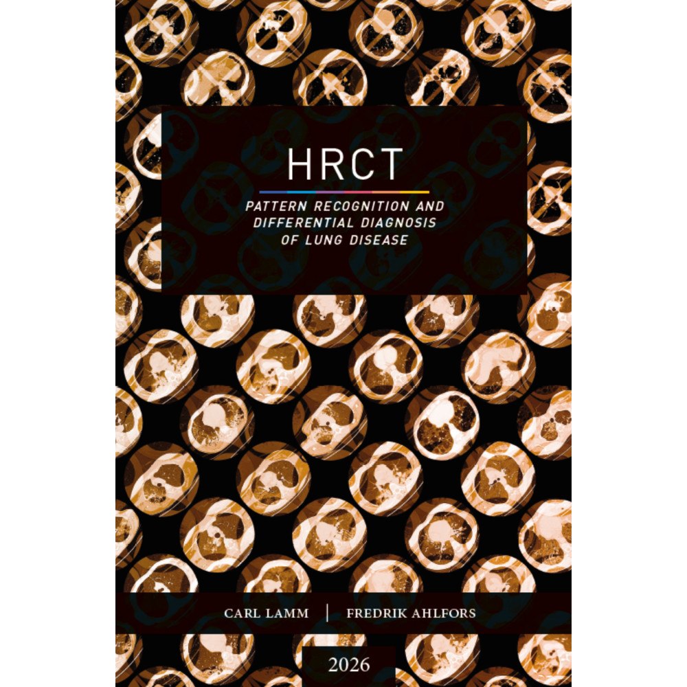 Carl Lamm HRCT : pattern recognition and differential diagnosis of lung disease (bok, danskt band, eng)
