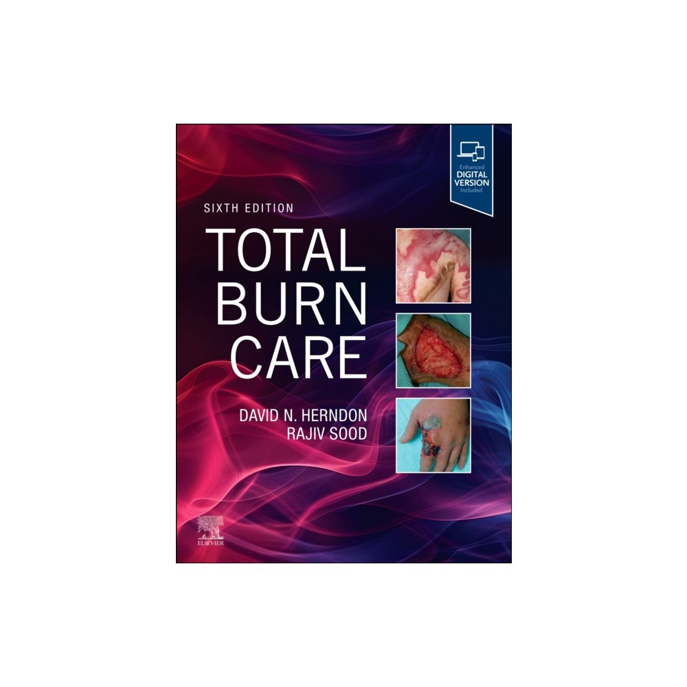Elsevier - Health Sciences Division Total Burn Care (inbunden, eng)