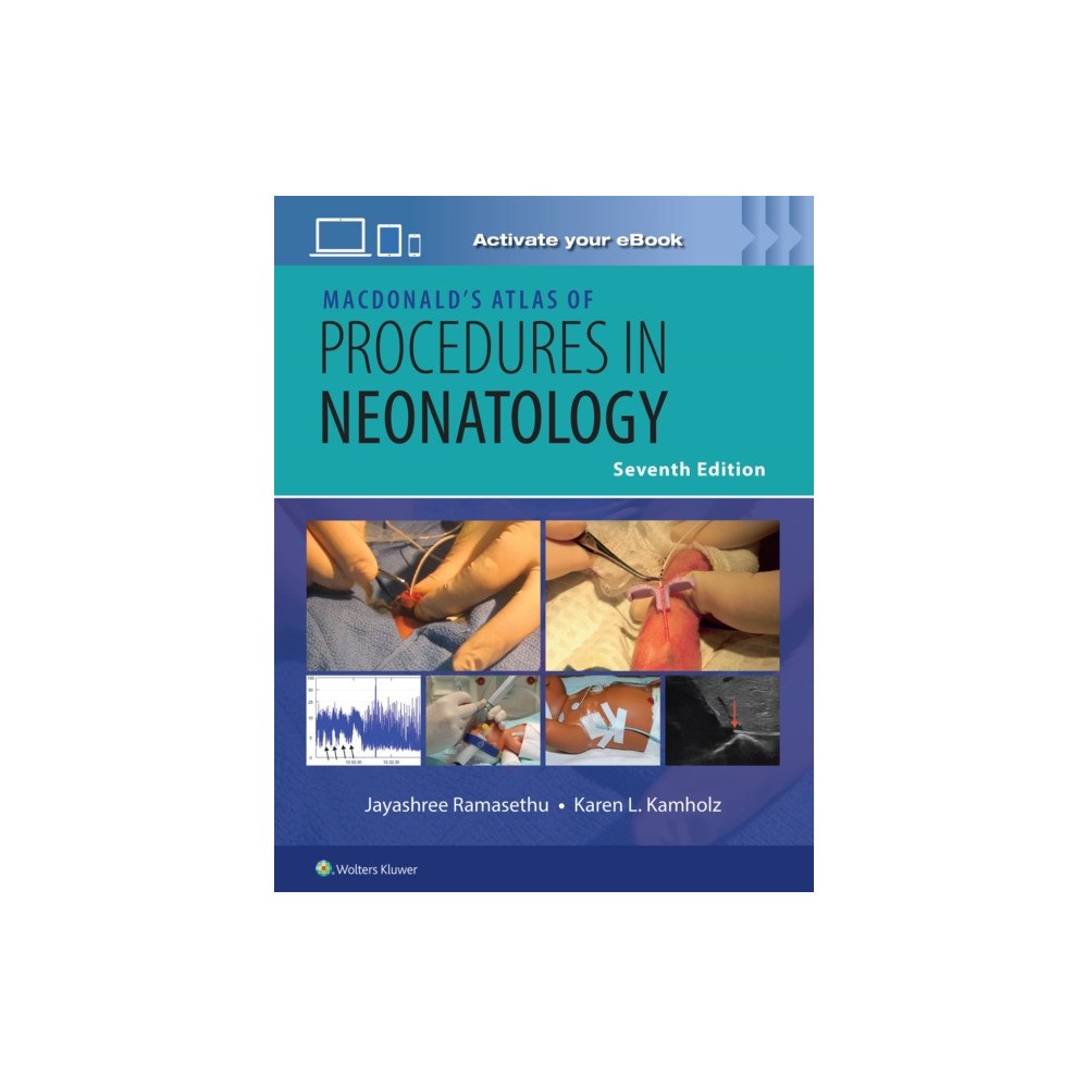 Wolters Kluwer Health MacDonald’s Atlas of Procedures in Neonatology Print + eBook with Multimedia (inbunden, eng)