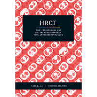 Carl Lamm HRCT : mustererkennung und Differentialdiagnostik von Lungenerkrankungen (bok, danskt band, ger)