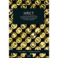 Carl Lamm HRCT : pattern recognition and differential diagnosis of lung disease (bok, danskt band, eng)