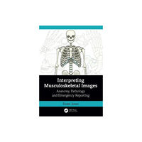 Taylor & francis ltd Interpreting Musculoskeletal Images (häftad, eng)