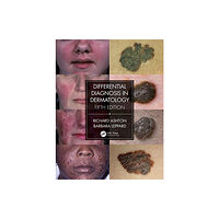 Taylor & francis ltd Differential Diagnosis in Dermatology (häftad, eng)
