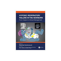 Taylor & francis ltd Hypoxic Respiratory Failure in the Newborn (häftad, eng)