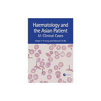 Taylor & francis ltd Haematology and the Asian Patient (häftad, eng)