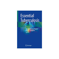 Springer Nature Switzerland AG Essential Tuberculosis (häftad, eng)