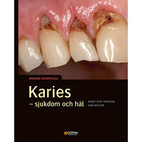 Bengt Olof Hansson Karies : sjukdom och hål (häftad)